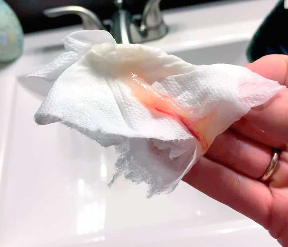 Exemple de bouchon muqueux légèrement teinté en fin de grossesse